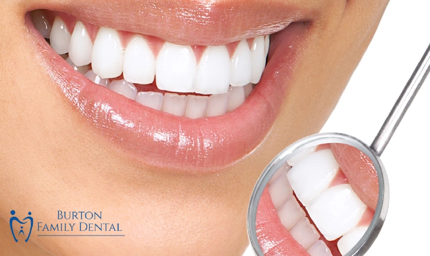 Burton Family Dental - Healthy Smile Image