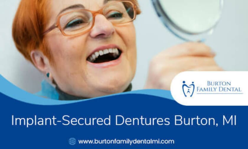 Burton Family Dental - Implant-Secured Dentures