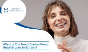 What Is The Need Conventional Metal Braces in Burton