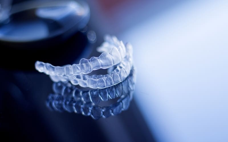 Are Clear Aligners Better Than Braces