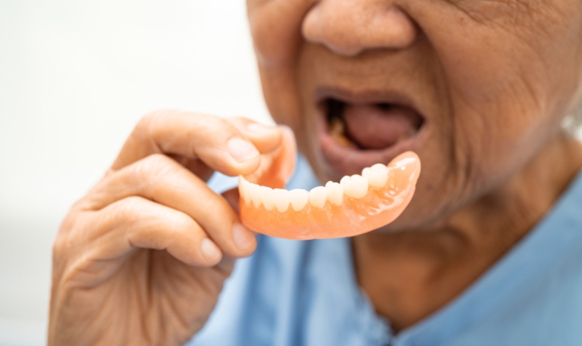 implant-secured dentures in Burton