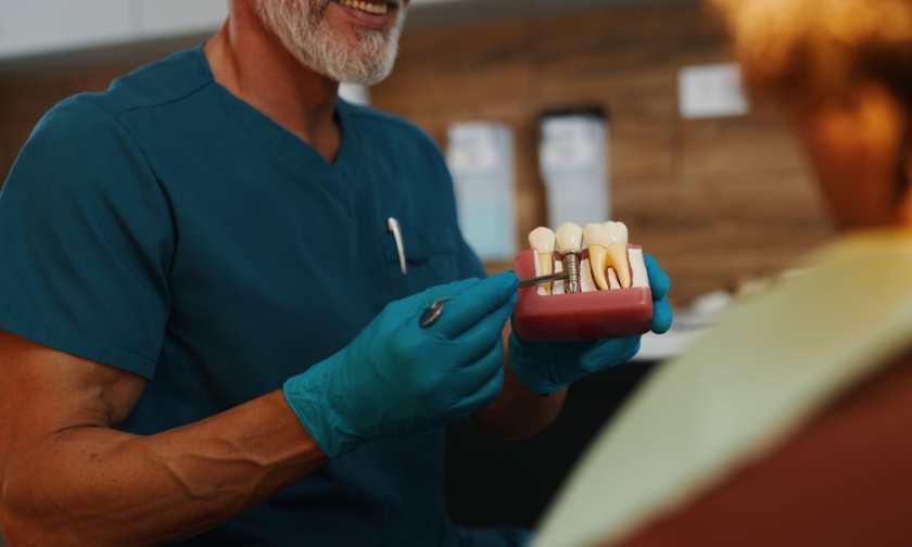 dental implants burton